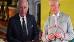 King Charles ‘sausage finger’ denotes severe health risks