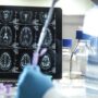 New Alzheimer’s drug slows memory loss