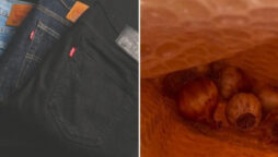 Woman orders used jeans online, receives onions