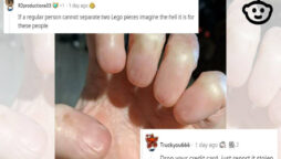 Netizens took a laugh at a Reddit user with Anonychia congenita