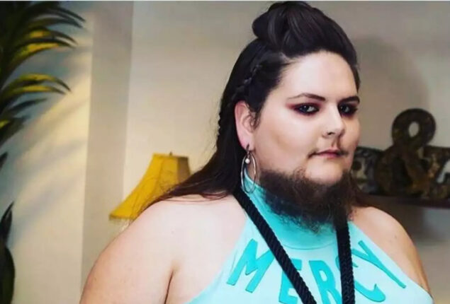Woman shave twice a day after growing beard at 13, like facial hair