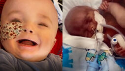 Baby celebrates first birthday after doctors said he only had a day