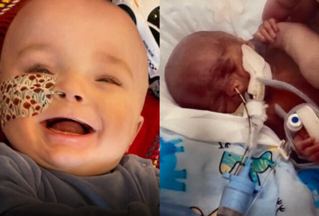 Baby celebrates first birthday after doctors said he only had a day