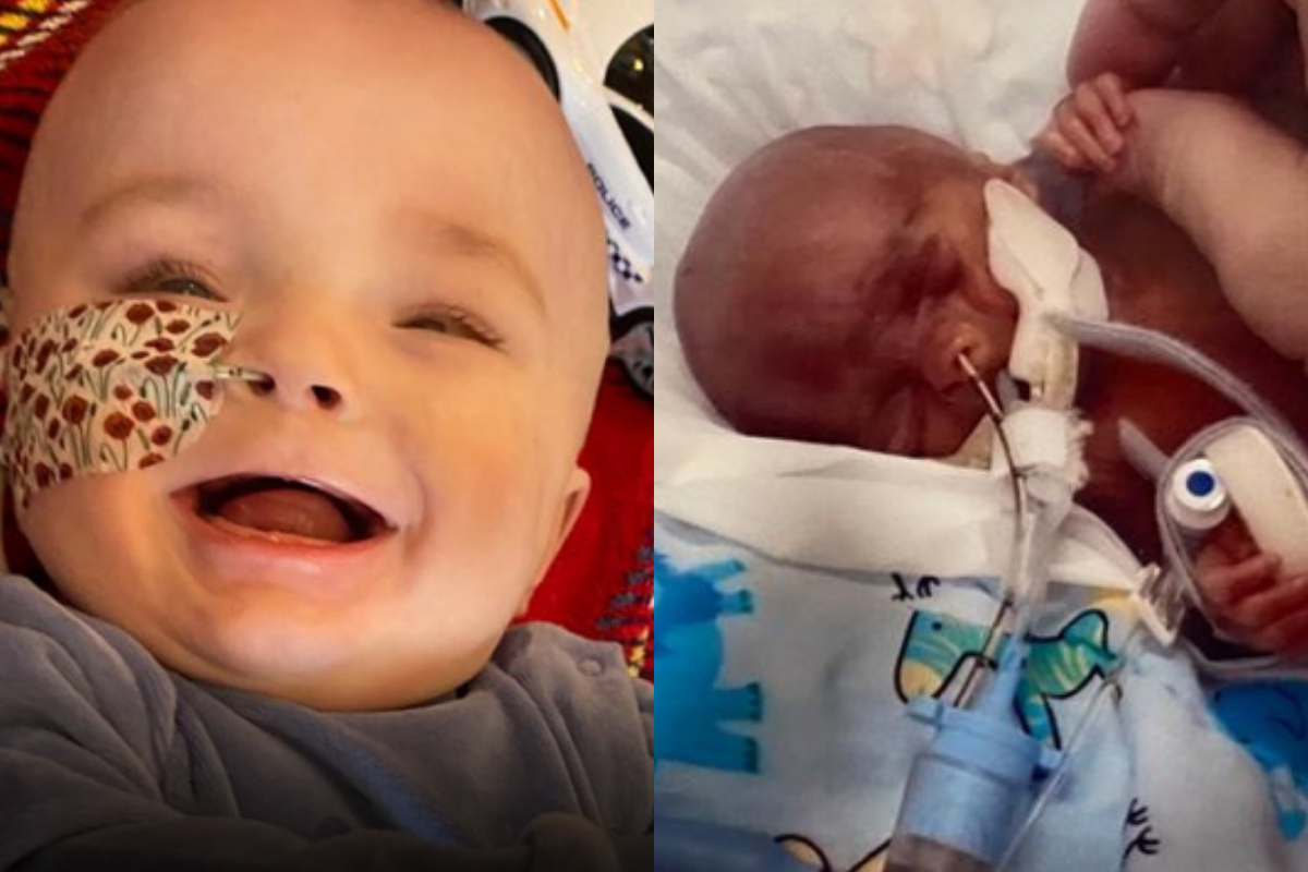 miracle baby