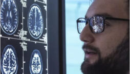 Lecanemab, an Alzheimer’s medication, is recognized as a huge breakthrough