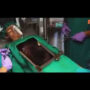 Film shows a heart flying through hospital window into body