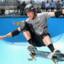 Tony Hawk claims that his femur was “surgically realigned”