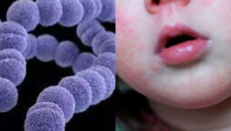 Strep A