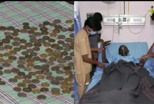 Bizarre Case: Karnataka Man Swallows 187 Coins stunned doctors
