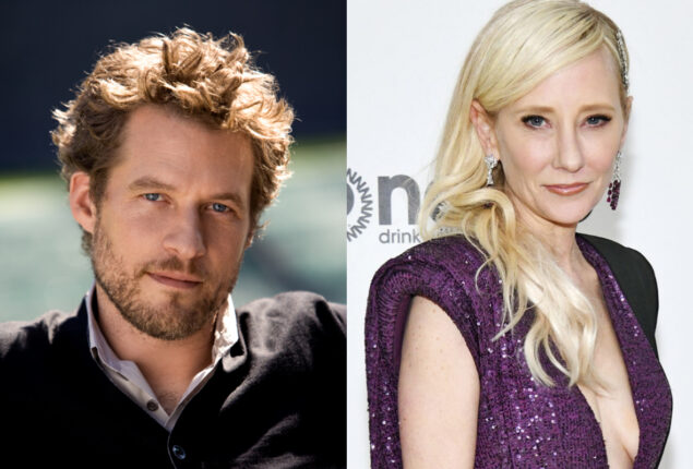 James Tupper admits to having a “difficult time” since her wife passed away