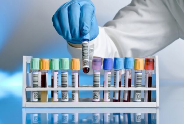 PHC seals 3 labs for forging medical test reports