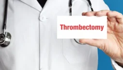 Health expert on Mechanical Thrombectomy