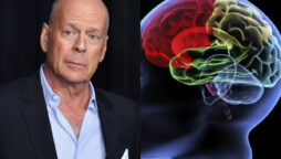 frontotemporal dementia
