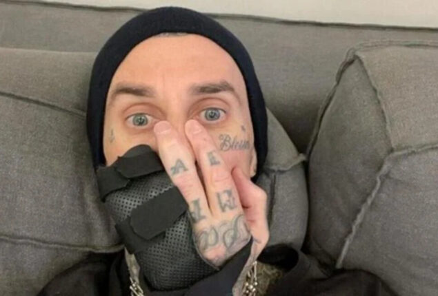 Travis Barker set for surgery to fix a broken finger