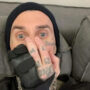 Travis Barker set for surgery to fix a broken finger