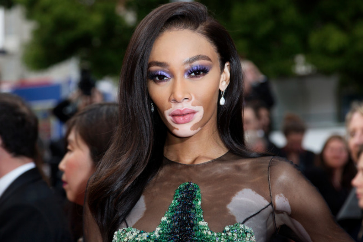 Winnie Harlow