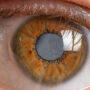 Glaucoma in children: symptoms, causes, and treatment