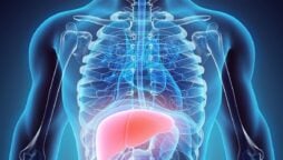 Liver cancer