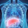 Liver cancer: Risk factors for rise in Hepatocellular Carcinoma cases