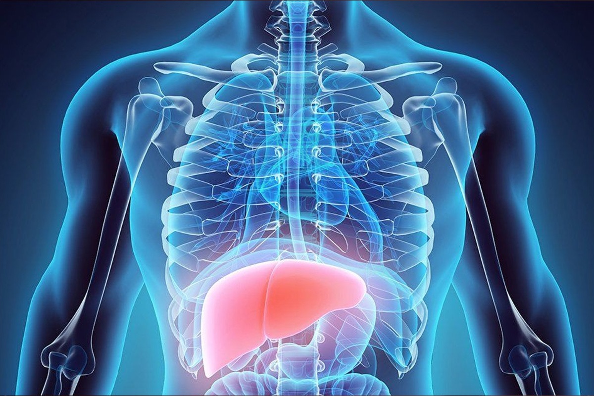 Liver cancer