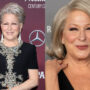Bette Midler spoken out against plastic surgery