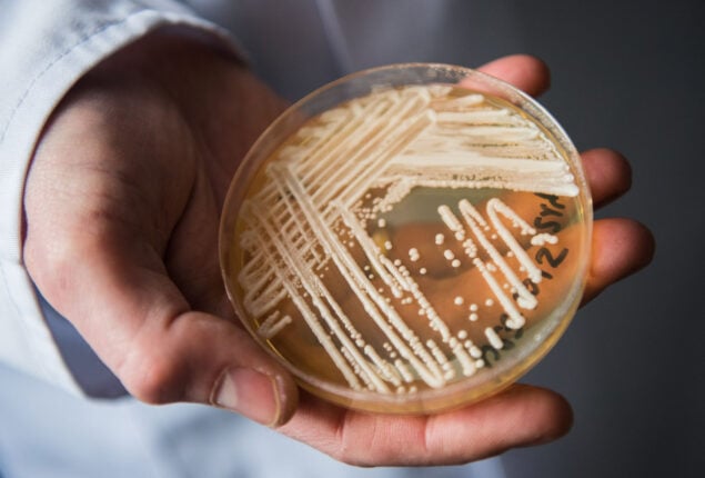 Candida auris fungal infections grows at alarmin rate in US