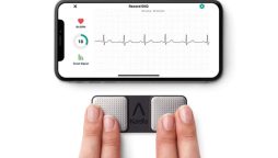 New AI heart scan can detect blockages before symptoms appear