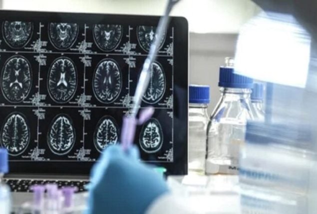 Alzheimer's Disease