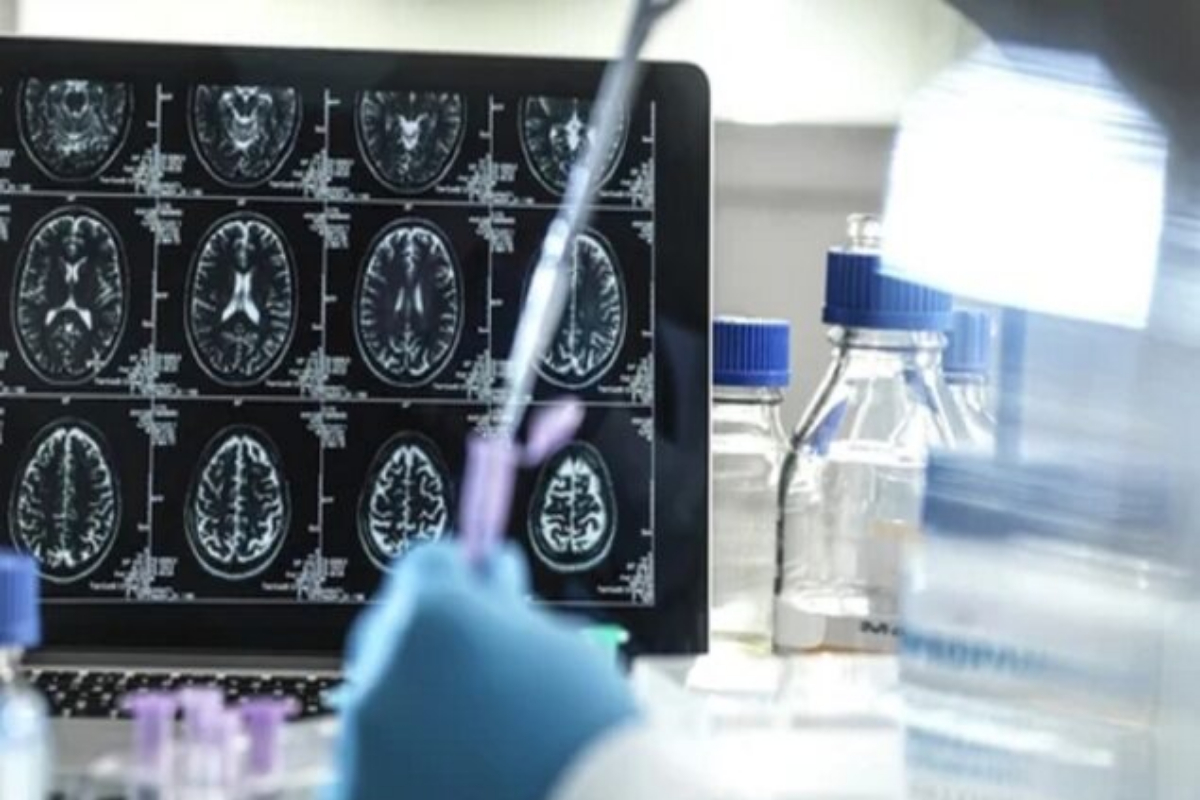 Alzheimer's Disease
