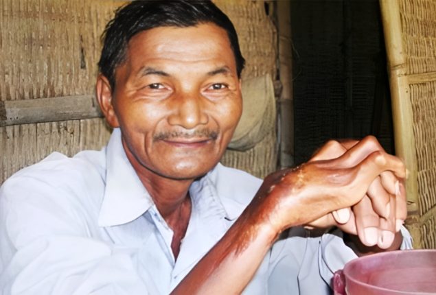 80-Year-Old Man Claims 60 Years without Sleep