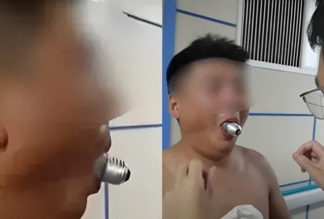 Man Gets Light Bulb Stuck in Mouth Attempting Online Challenge