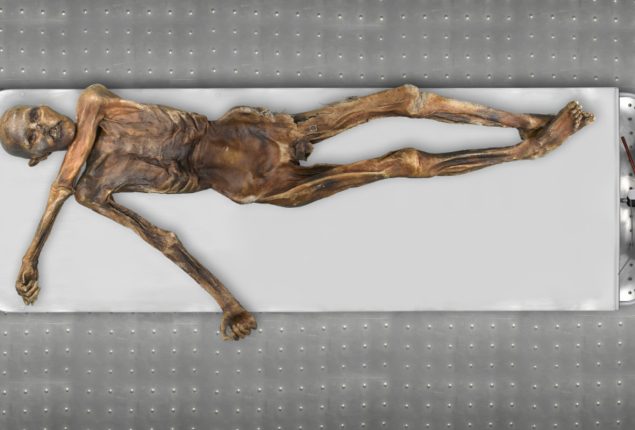 Oetzi the Iceman
