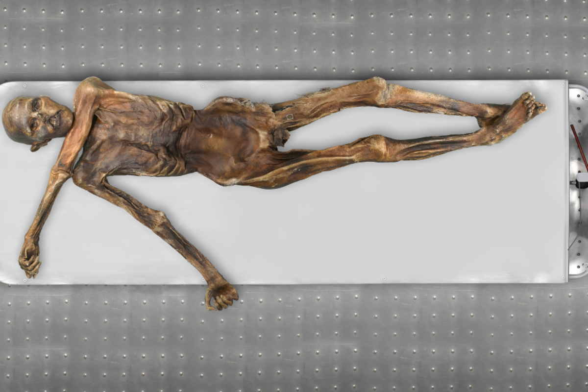 Oetzi the Iceman