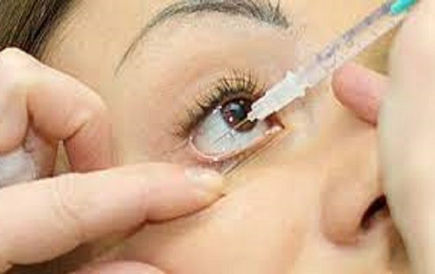 Vision loss: purchase, sale of Avastin injections banned in Sindh