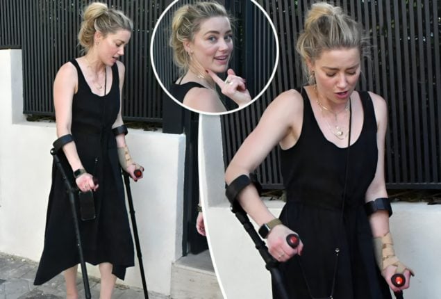 Amber Heard on Crutches in Madrid Post ‘Aquaman 2’