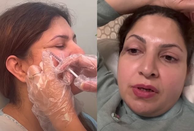 Shagufta Ejaz shares her Botox journey