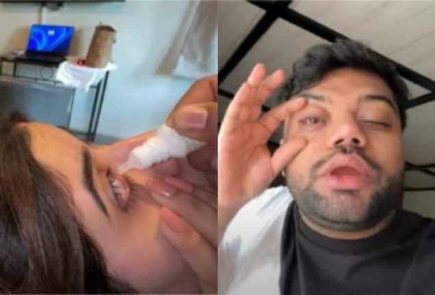 Ducky Bhai and Aroob’s Eye Infection Sparks Concern Among Fans