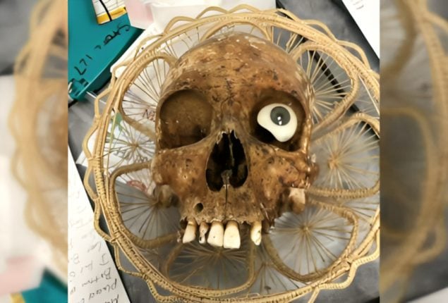 Human Skull