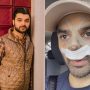 No Secrets Here: MUA Omayr Waqar Talks About His Cosmetic Surgery Transformation