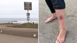 Surfer, 52, Shark-Bitten at Popular Tourist Beach