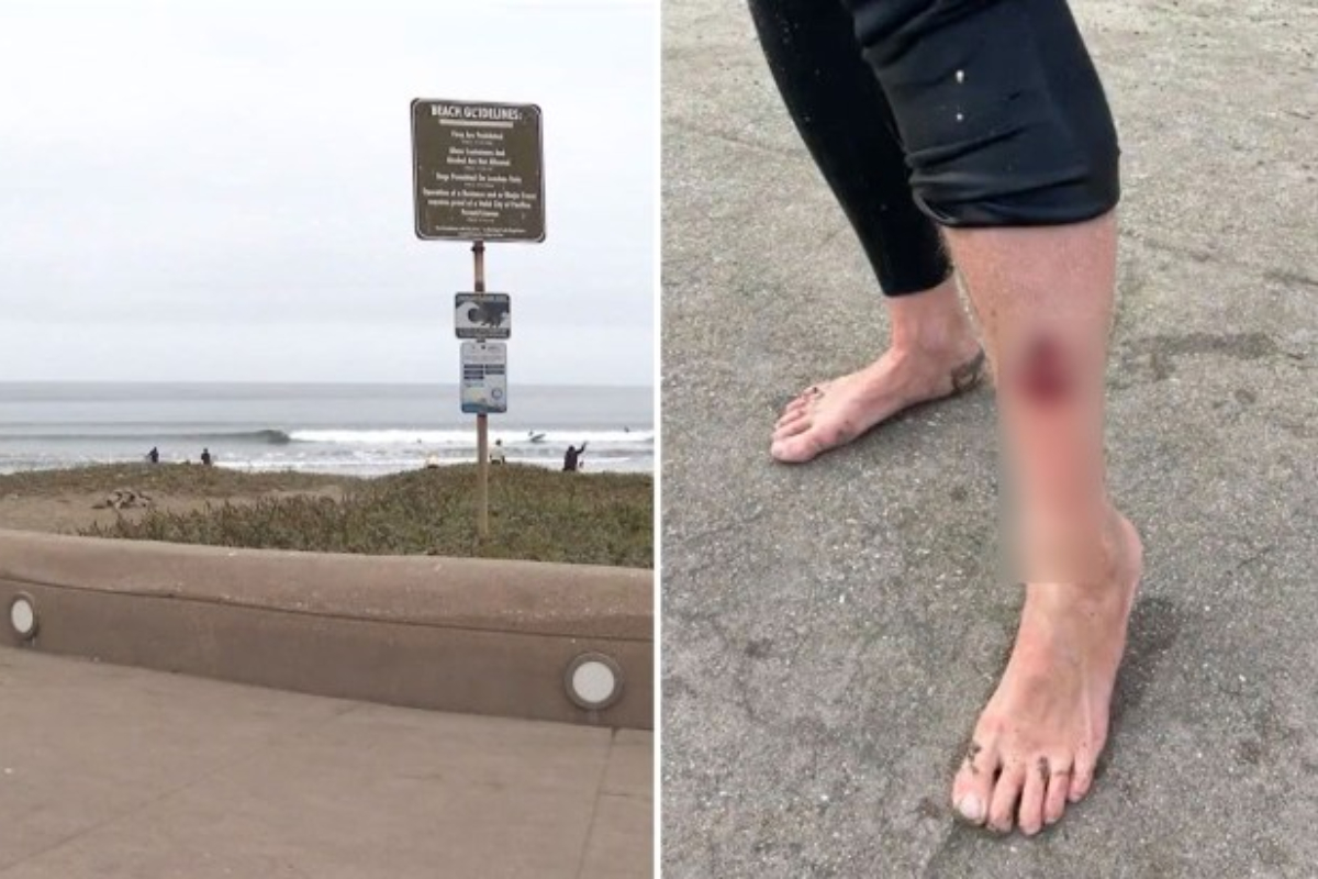 Surfer, 52, Shark-Bitten at Popular Tourist Beach