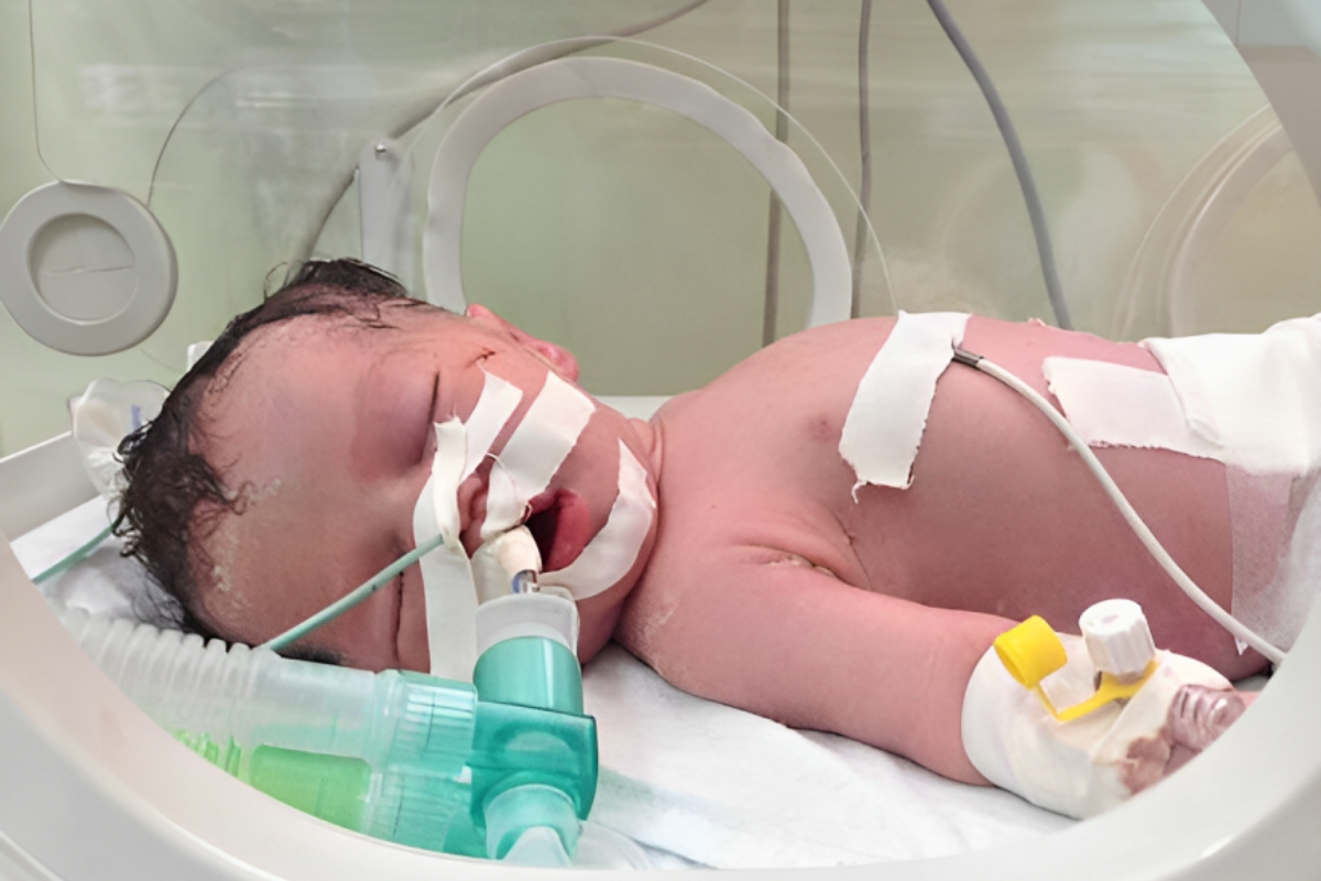 Miracle Baby