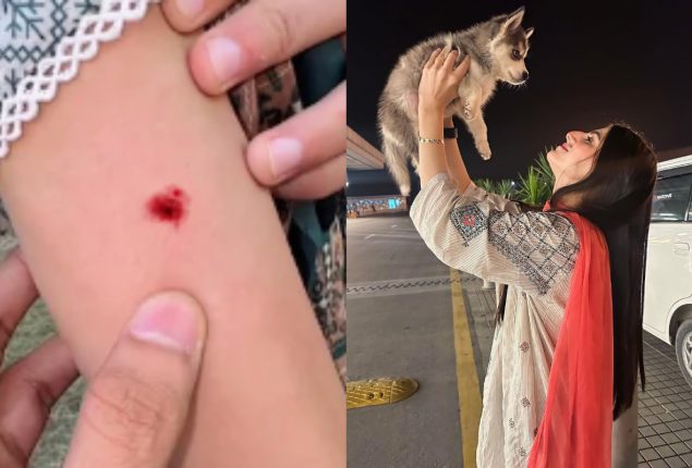 YouTuber Maaz Safder’s Wife Saba Recently Bitten by a Dog