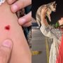 YouTuber Maaz Safder’s Wife Saba Recently Bitten by a Dog