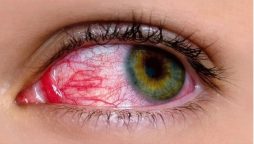 Use of antibiotics, steroids in conjunctivitis can affect eyesight: experts