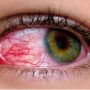 Use of antibiotics, steroids in conjunctivitis can affect eyesight: experts