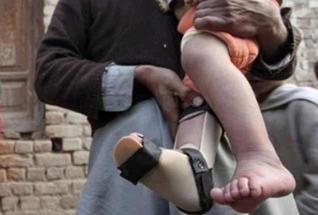 Fifth polio case detects in Pakistan