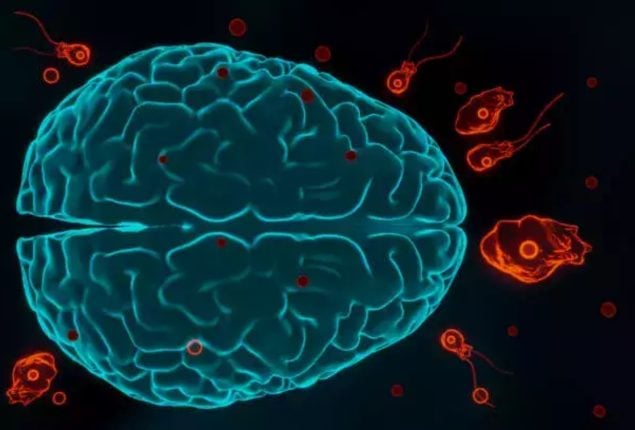 Naegleria claims another life in Karachi