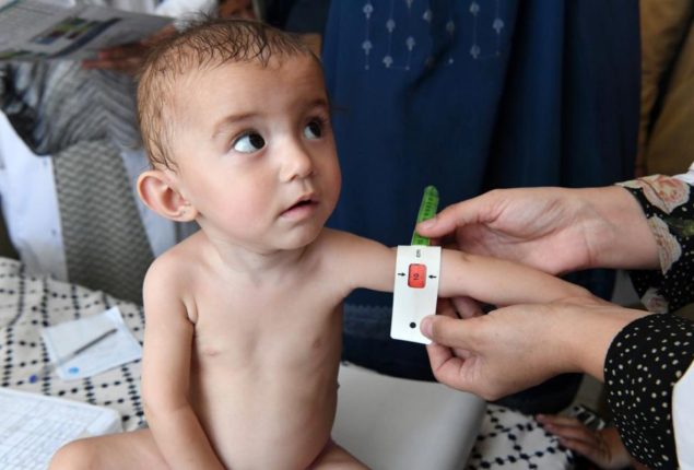 Interim Health Minister expresses resolve to deal with malnutrition