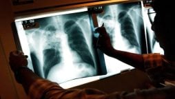 TB patients